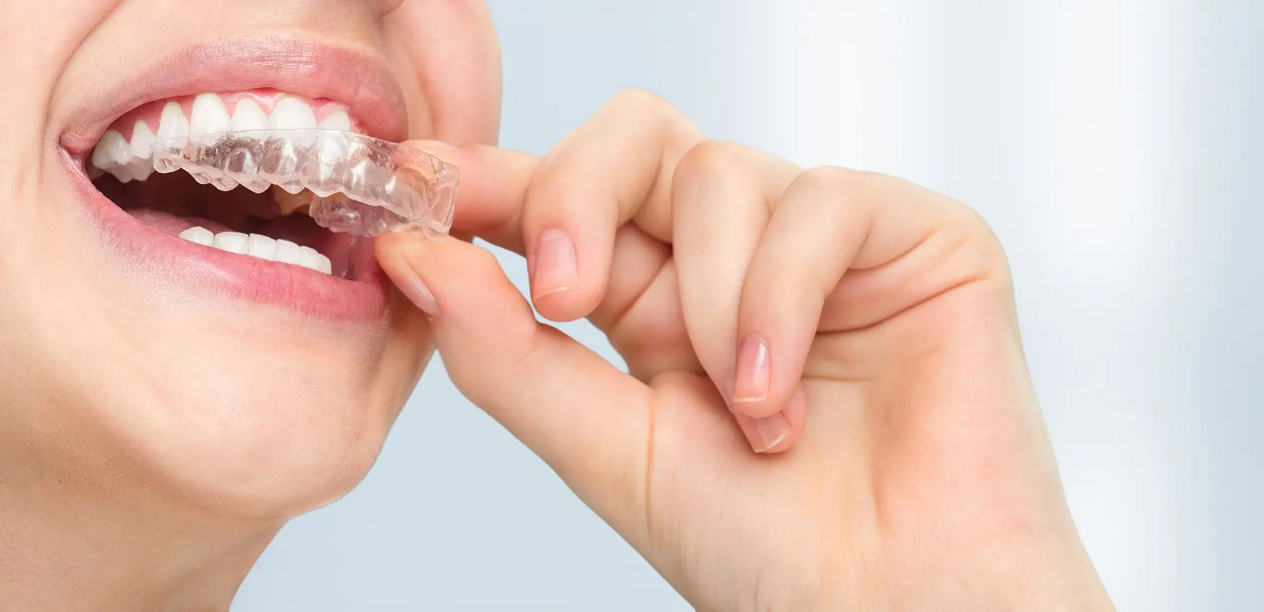 şeffaf plak kimlere uygulanır