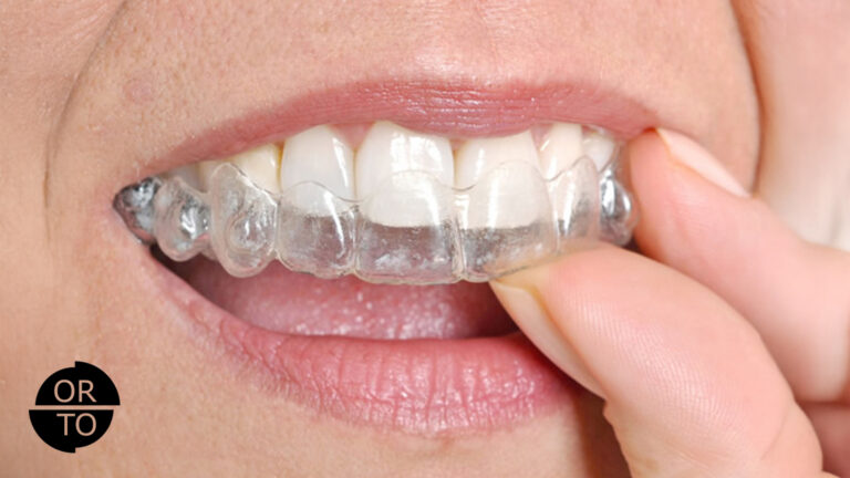 şeffaf plak fiyatları