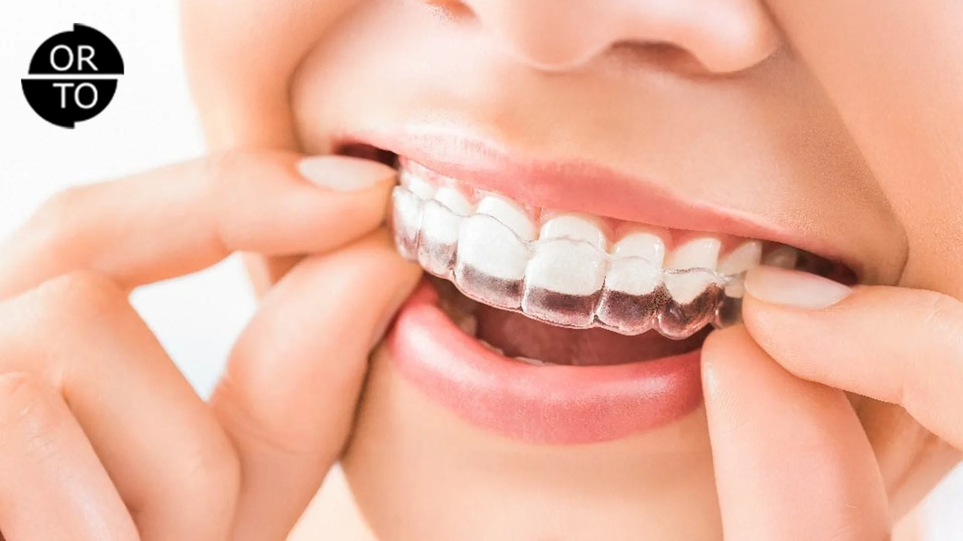 şeffaf-plaklar-gerçekten-etkili-mi