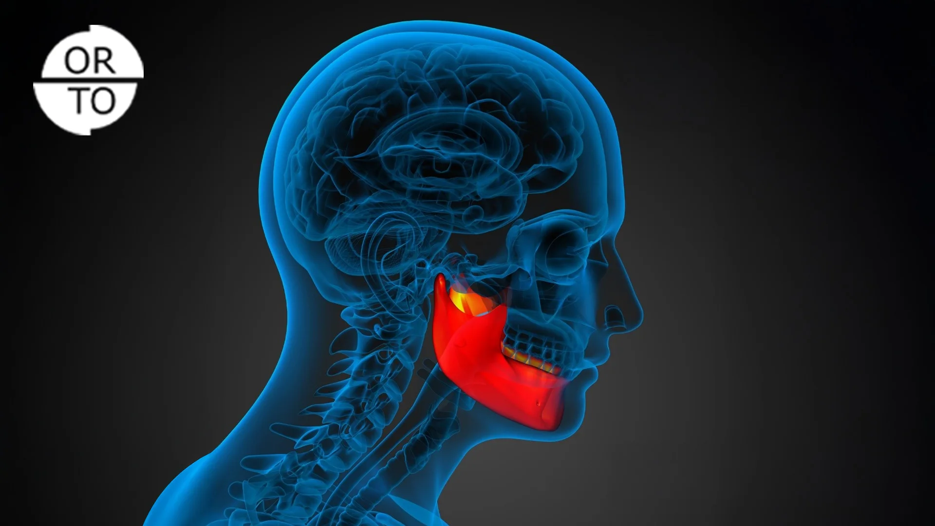 çene çıkması nedir nasıl anlaşılır