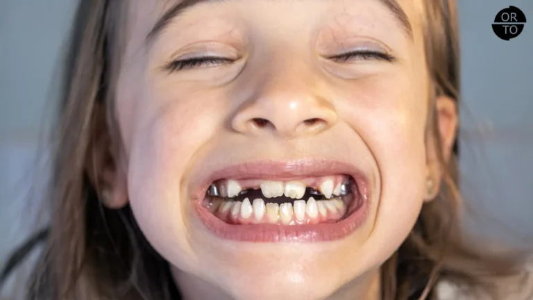 Gözleri kapalı şekilde gülen ve süt dişleri çarpık küçük bir kız çocuğu