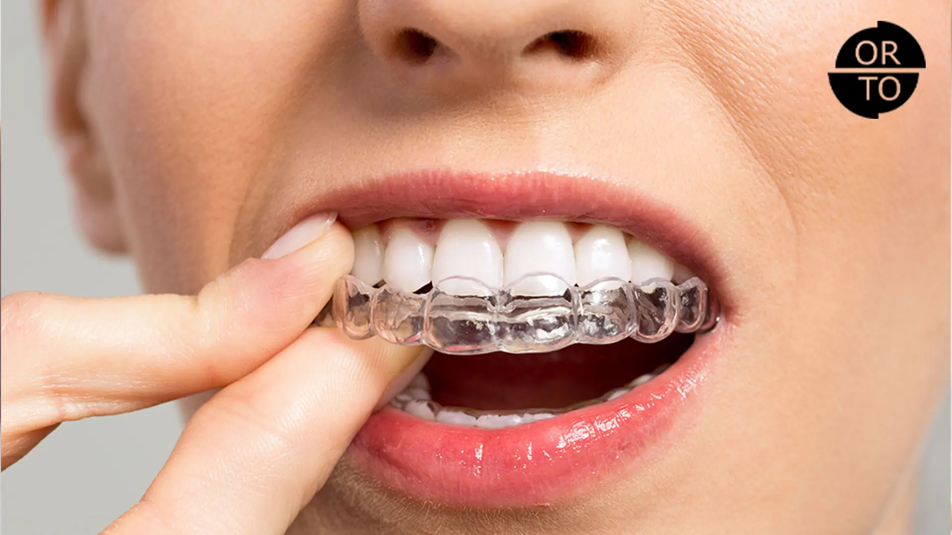 ortodonti-fiyatları-2025