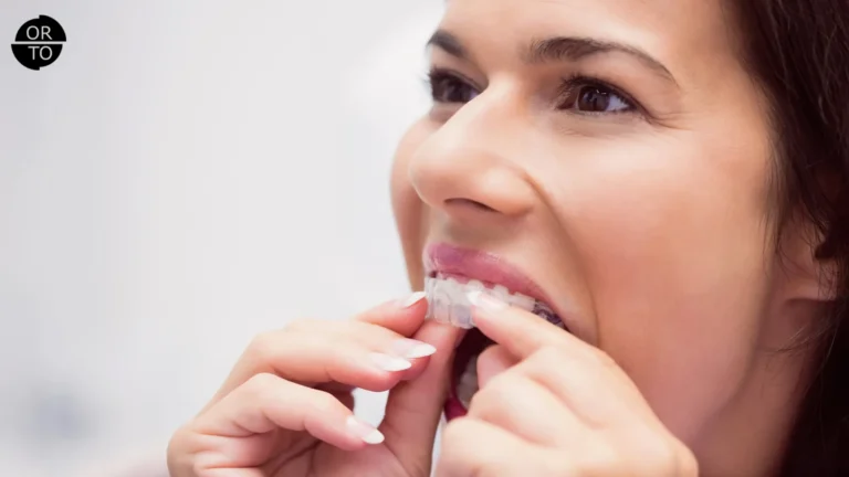 Şeffaf plak (aligner) takan bir kadın