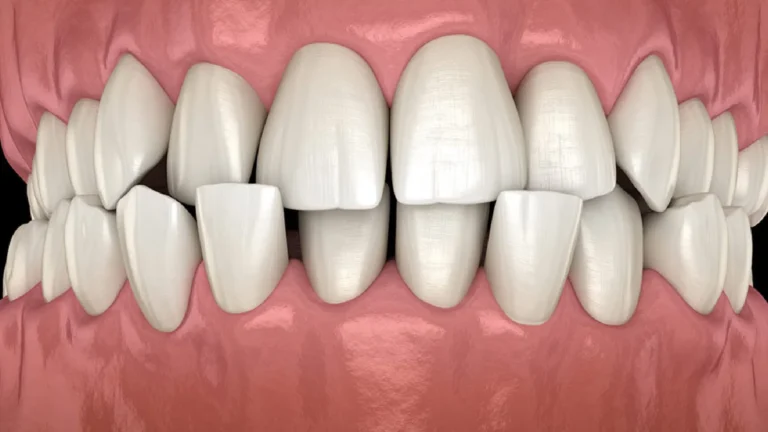 ortodontik tedavi ile hangi problemler düzeltilebilir