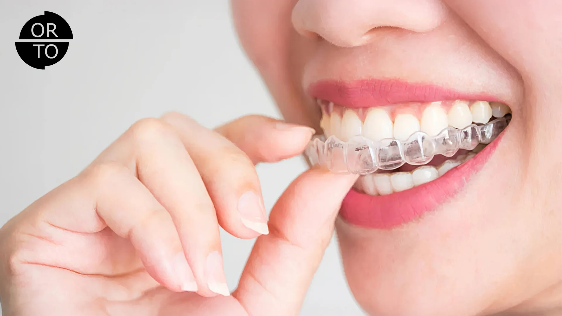 Şeffaf Plaklar Konuşmayı Etkiler mi