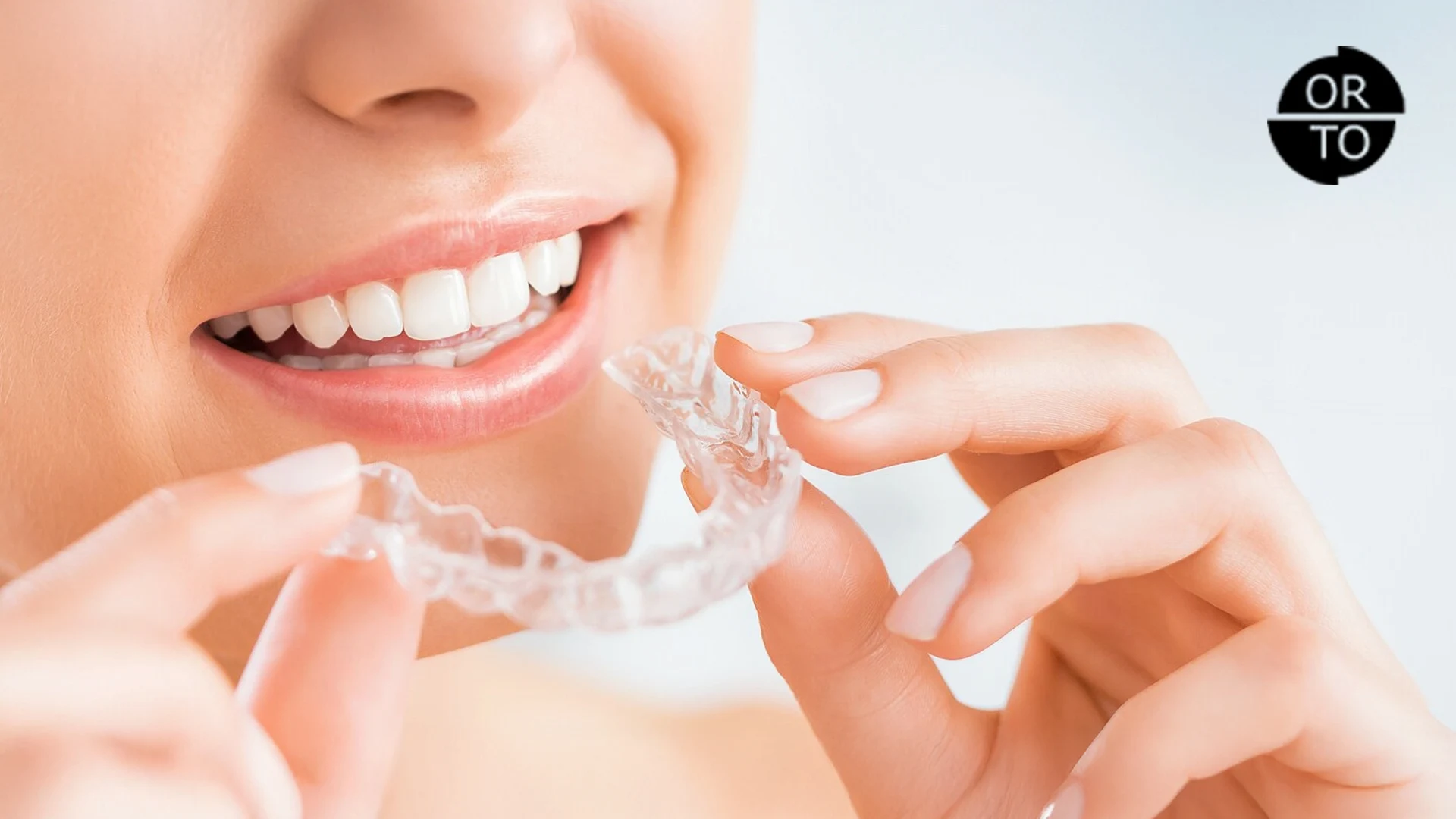 Invisalign Tedavi Süreci Nasıldır Hangi Aşamaları İçerir