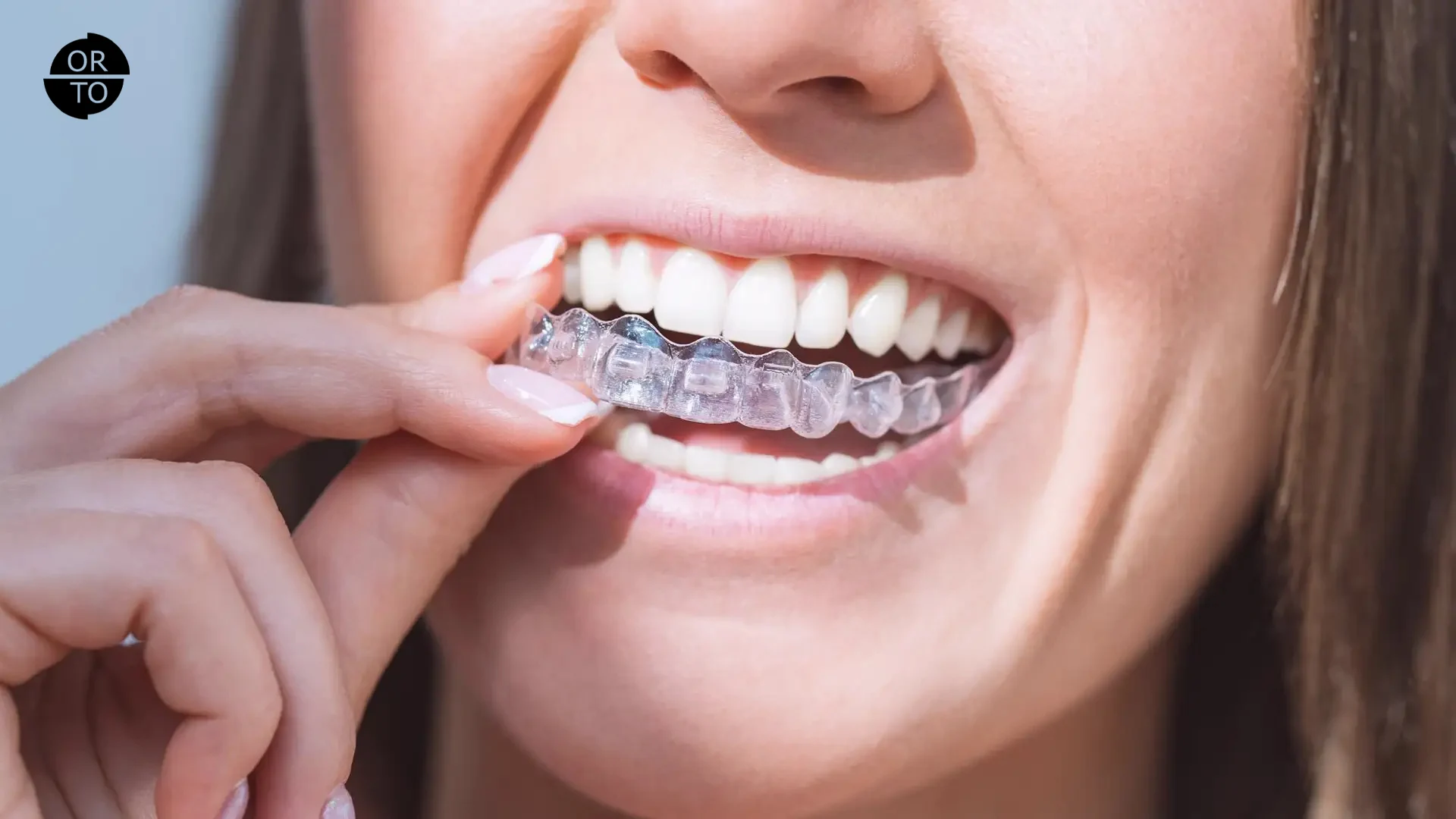Invisalign-(Şeffaf-Plak)-Ağrılı-Bir-Tedavi-mi