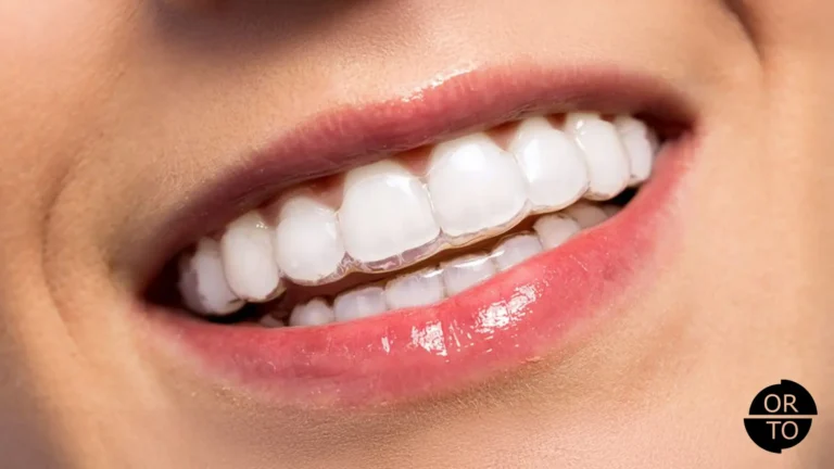 Şeffaf-Plaklar-Ağrı-Yapar-mı