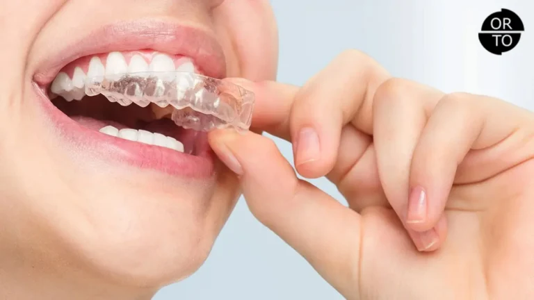 Alt Çene Geriliği Şeffaf Plaklarla Tedavi Edilir mi