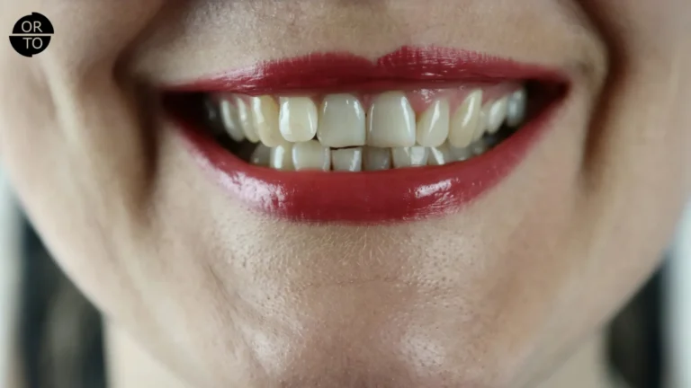 Dişlerini sıkan bir kadının dudakları ve çapraşık ön dişleri yakın planda görülüyor