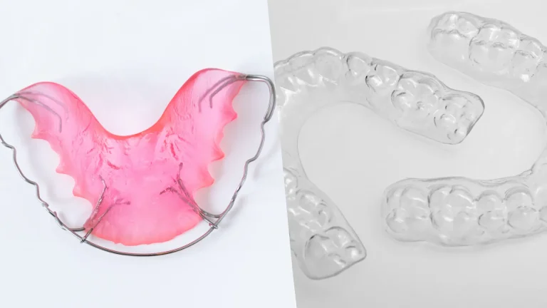 sabit-retainer